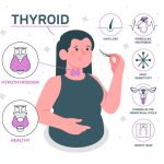 hypothyroidism symptoms