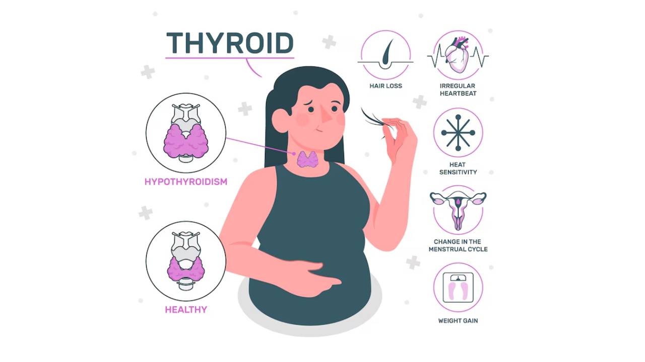 hypothyroidism symptoms